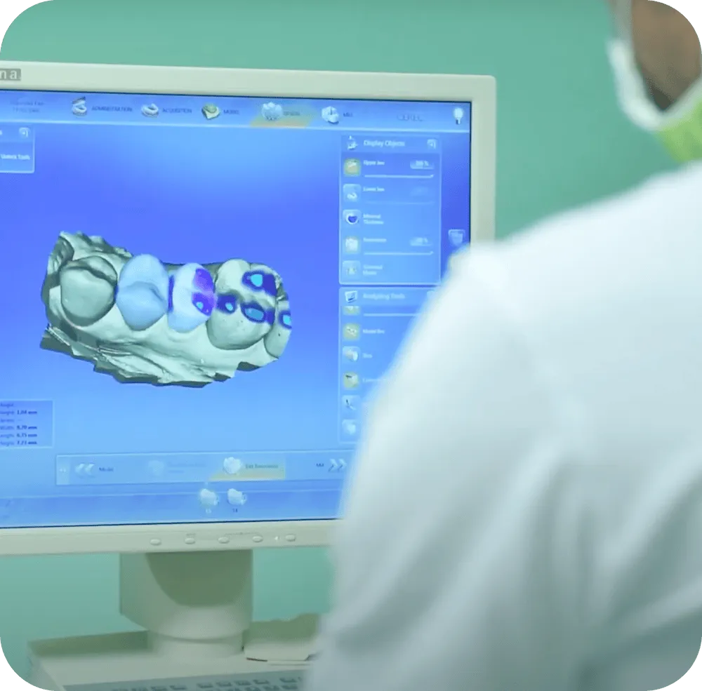 endodoncie