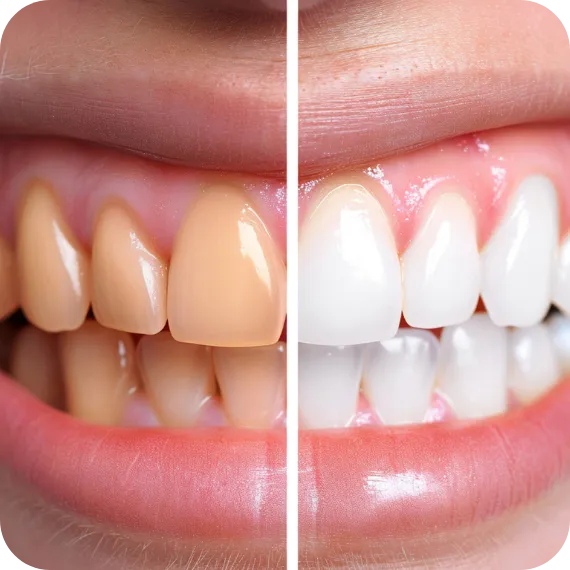 Pure Whitening