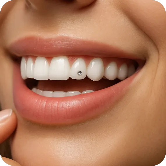 dentální šperk