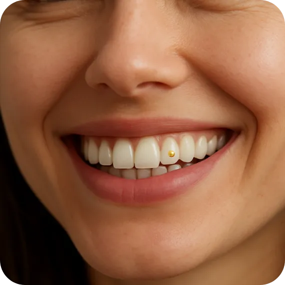 dentální šperk