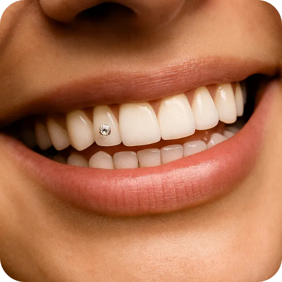 dentální šperk